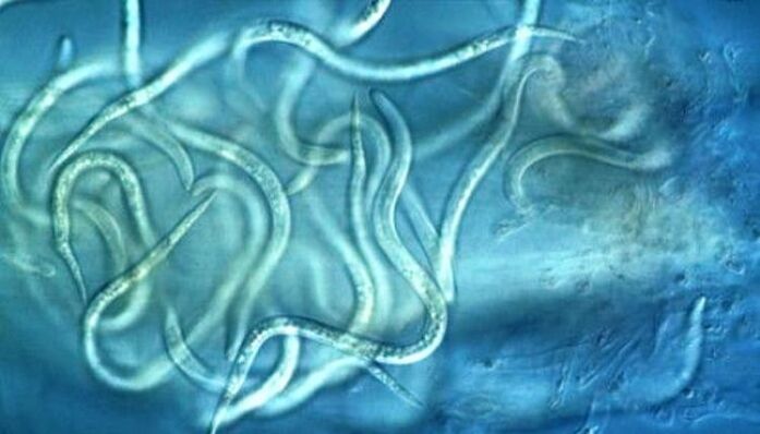como são os parasitas nematóides no corpo humano
