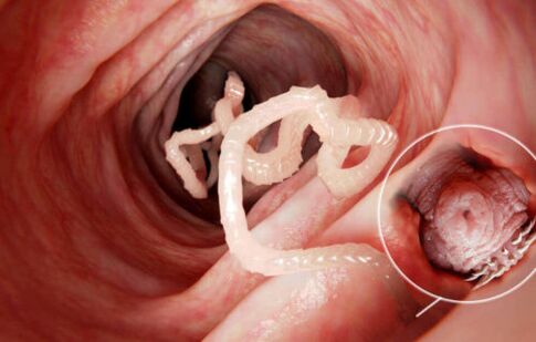 o verme é um parasita do corpo humano