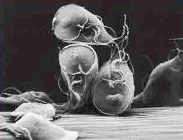 protozoário parasita giárdia